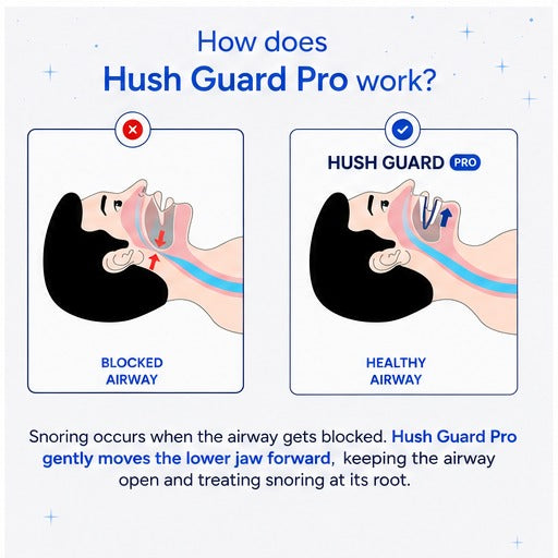 Hush Guard Pro™ — Adjustable Anti-Snoring Mouthpiece