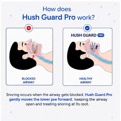 Hush Guard Pro™ — Adjustable Anti-Snoring Mouthpiece